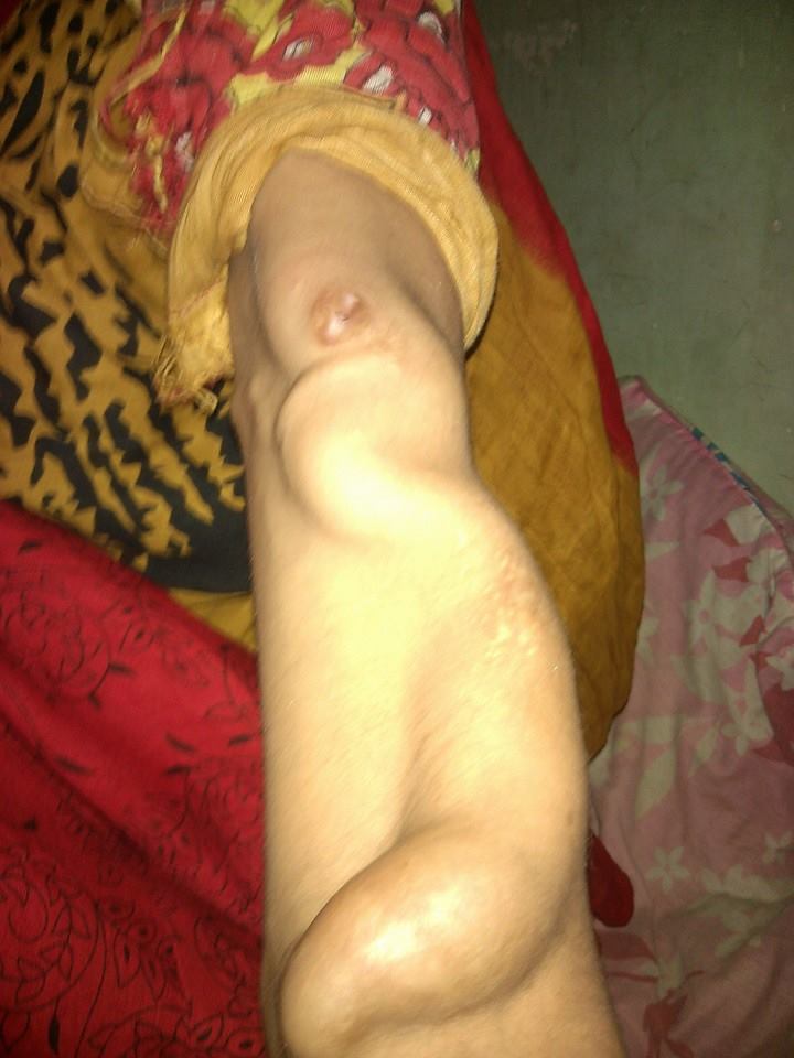 A patient whose treatment was supported by SWA